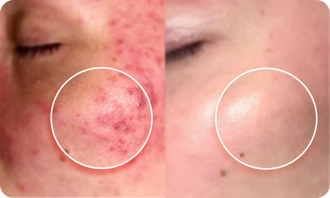 Mose Phục Hồi