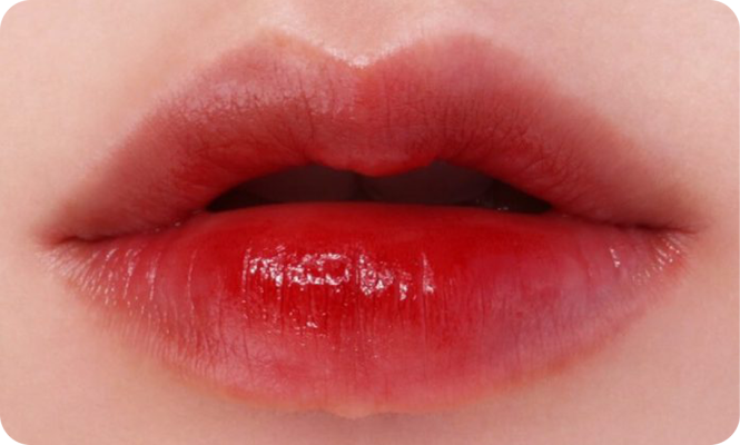 Filler tạo hình môi baby lip