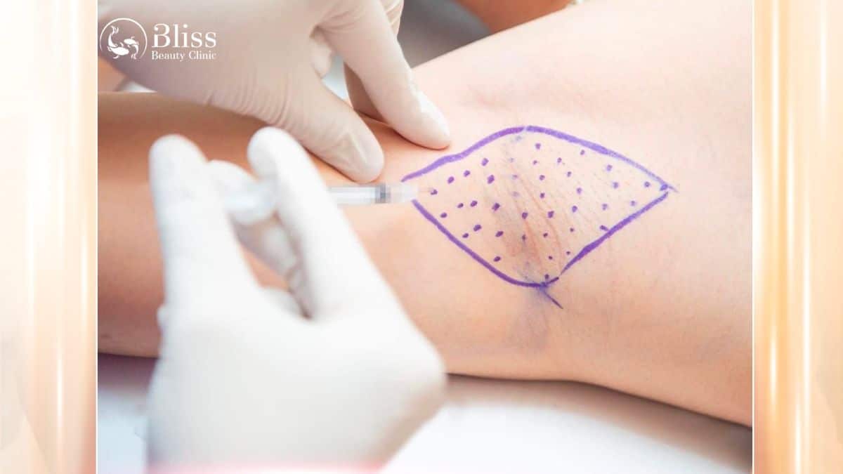 tiem-botox-tri-hoi-nach-co-an-toan-khong-gia-bao-nhieu