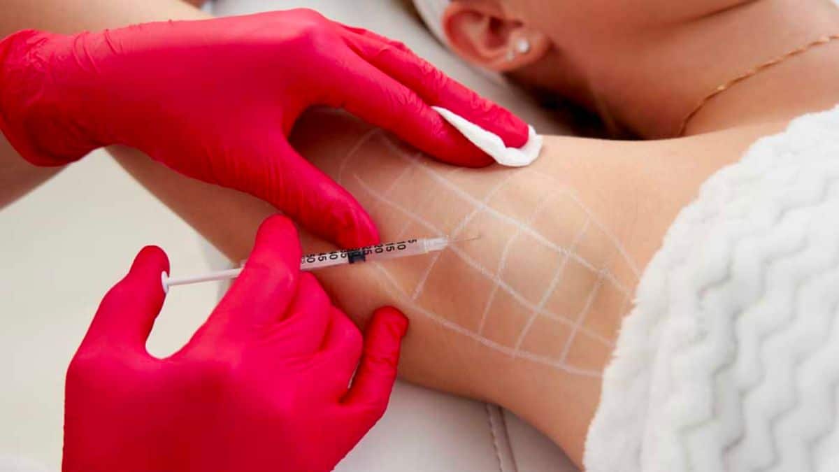 tiem-botox-tri-hoi-nach-co-an-toan-khong-gia-bao-nhieu