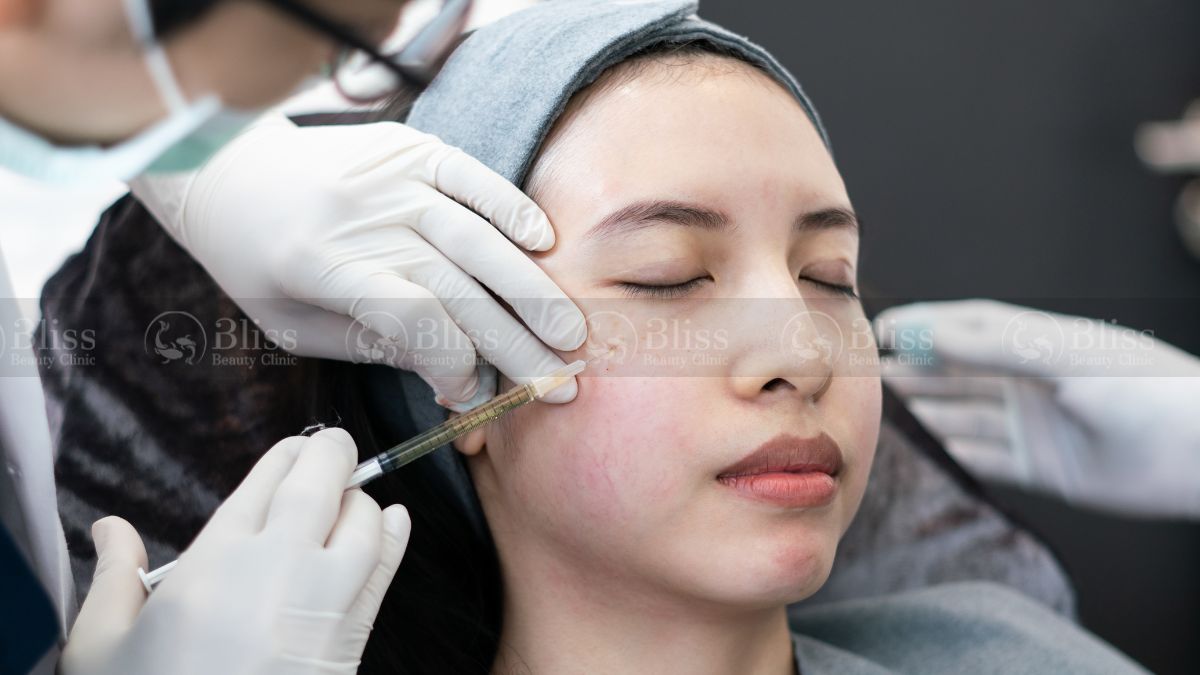 mesocell-extra-la-gi Tiêm meso