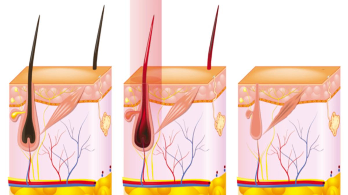 triet-long-nach-vinh-vien-cong-nghe-dpl-frey-2023