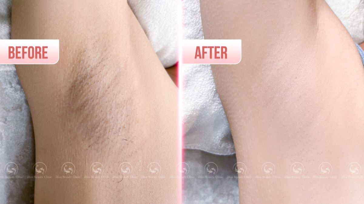 triet-long-nach-vinh-vien-cong-nghe-dpl-frey-2023