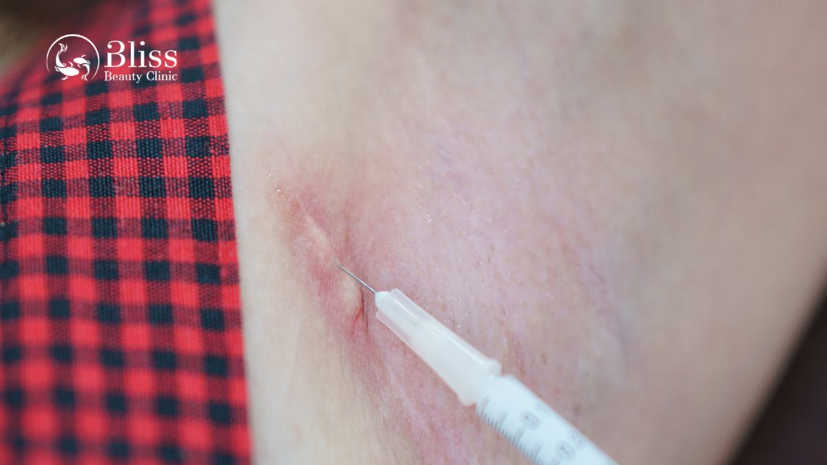 dieu-tri-seo-loi-hyper-scar-repair-3n1