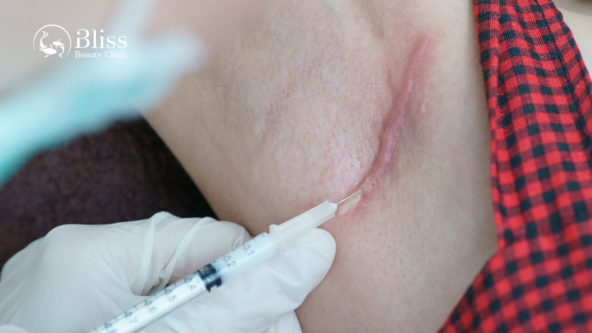 dieu-tri-seo-loi-hyper-scar-repair-3n1