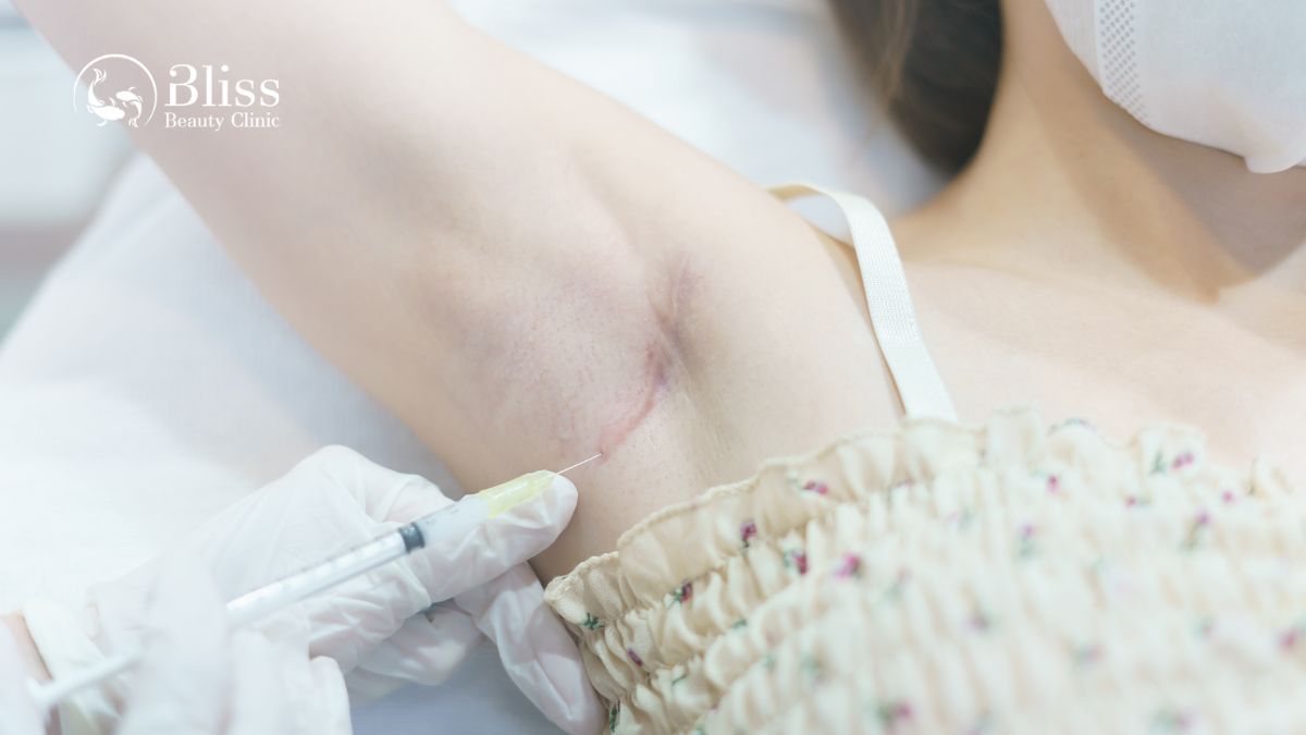 dieu-tri-seo-loi-hyper-scar-repair-3n1