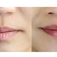 gel-duong-moi-image-md-restoring-lip-enhancer-spf15-15ml