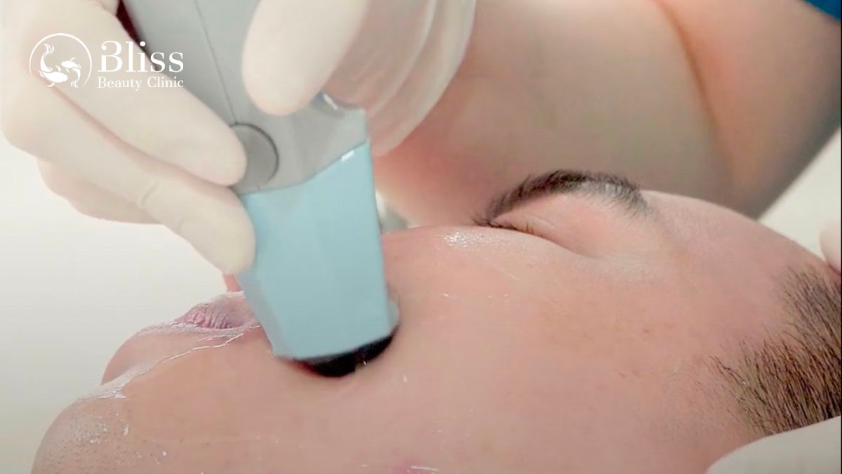 nang-co-tre-hoa-da-exilift-face