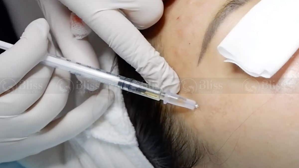 tiem-mesocell-extra-tri-nam