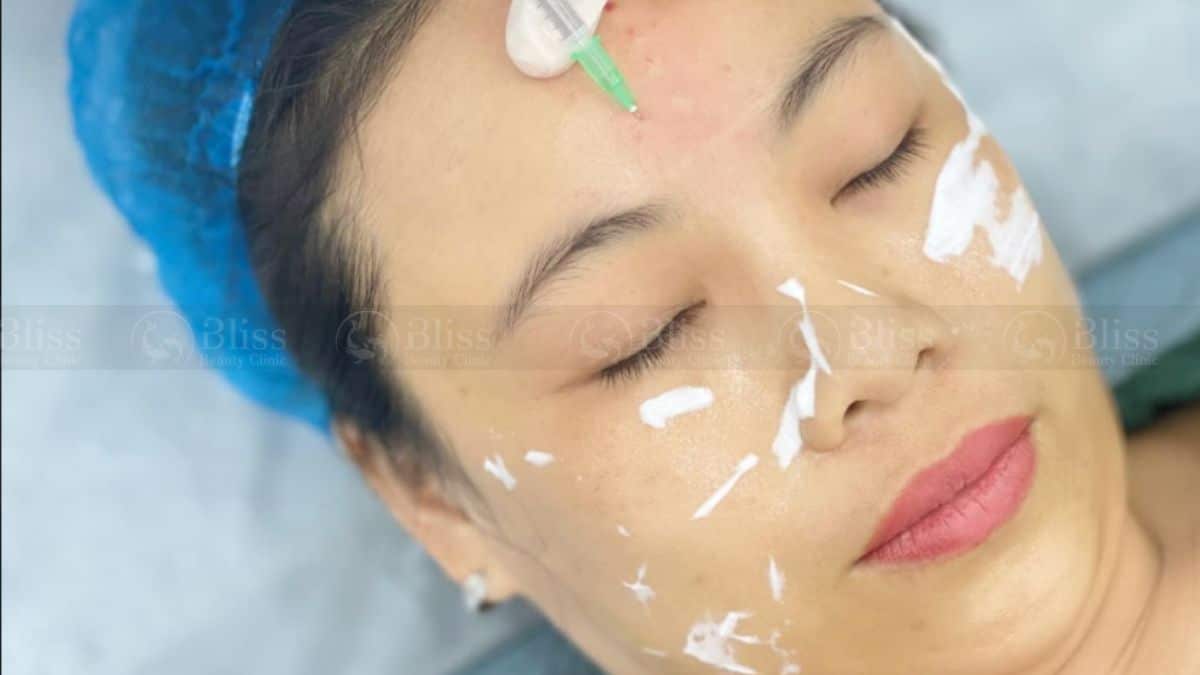 tiem-mesocell-extra-tri-nam