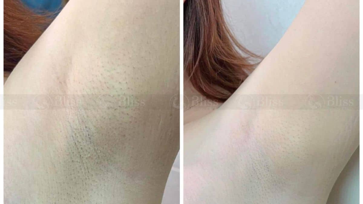 triet-long-gia-re-go-vap-49k-bang-gia-triet-long-2023