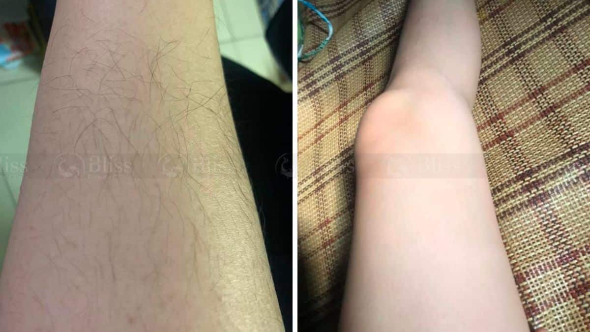 triet-long-gia-re-go-vap-49k-bang-gia-triet-long-2023