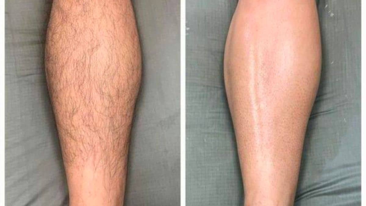 triet-long-gia-re-go-vap-49k-bang-gia-triet-long-2023