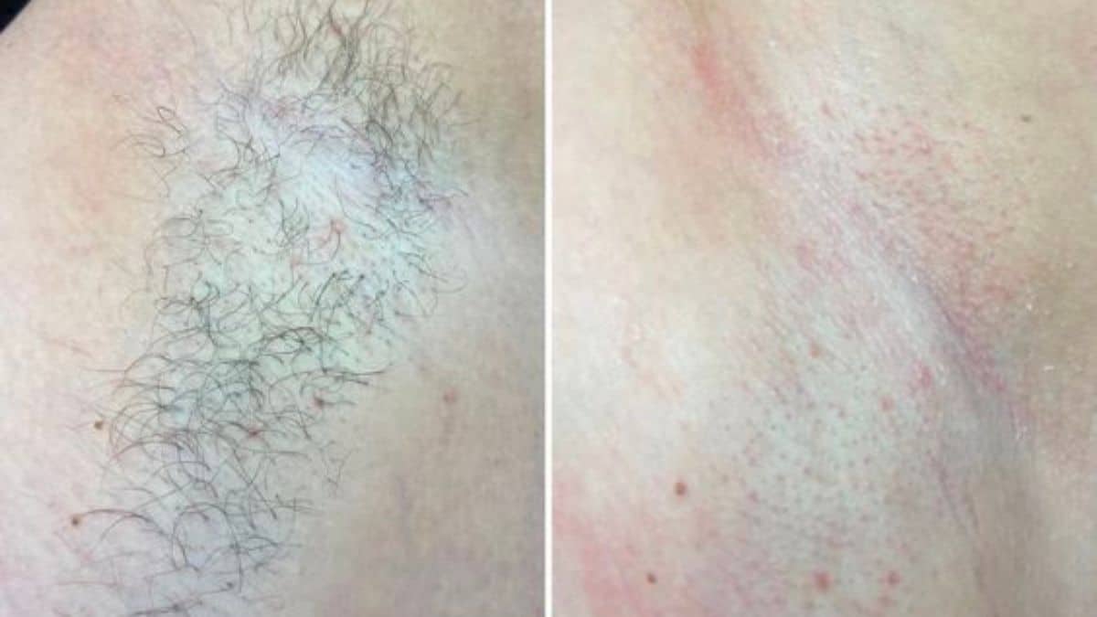 triet-long-gia-re-go-vap-49k-bang-gia-triet-long-2023