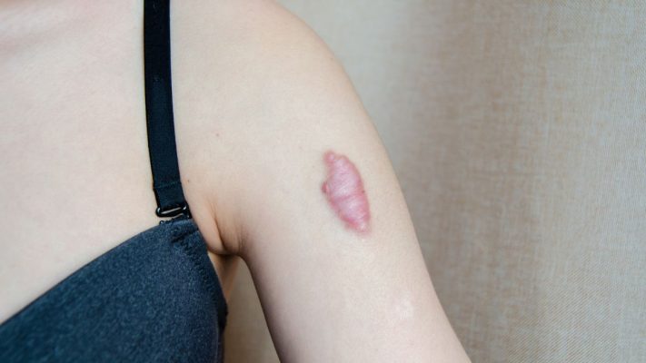 tri-seo-loi-gia-re-tot-nhat-tai-go-vap