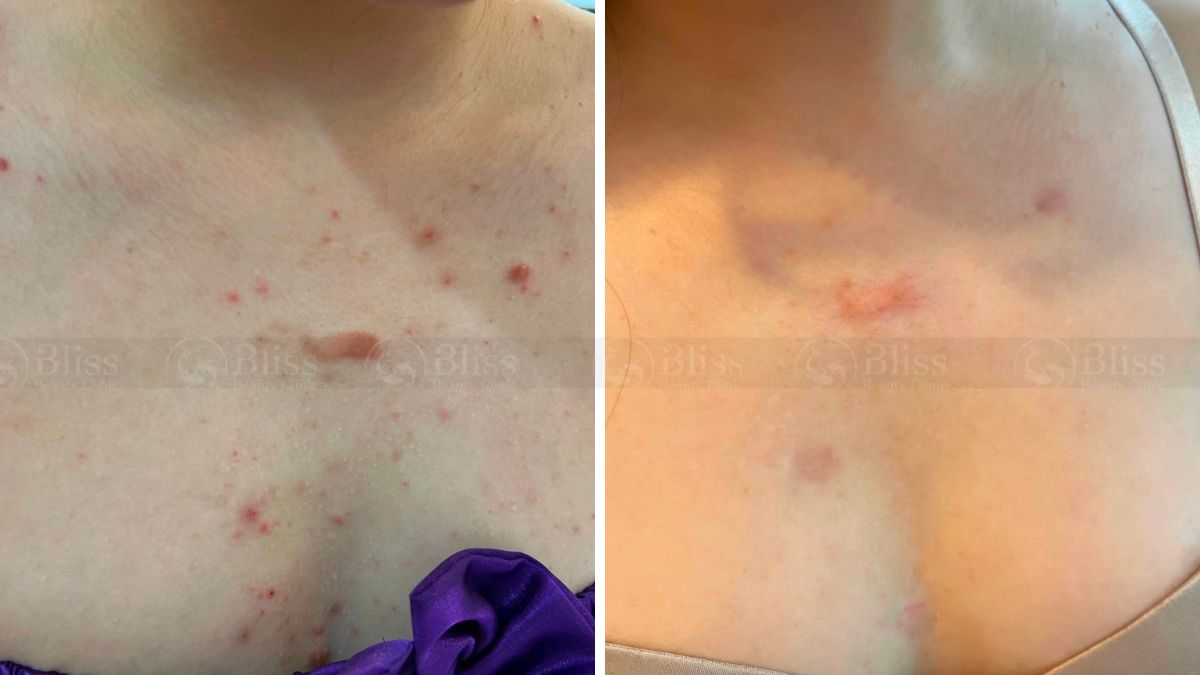 tri-seo-loi-gia-re-tot-nhat-tai-go-vap