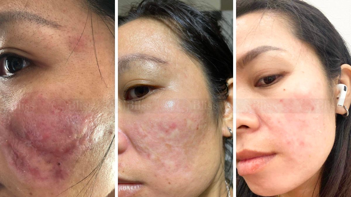 tri-seo-loi-gia-re-tot-nhat-tai-go-vap