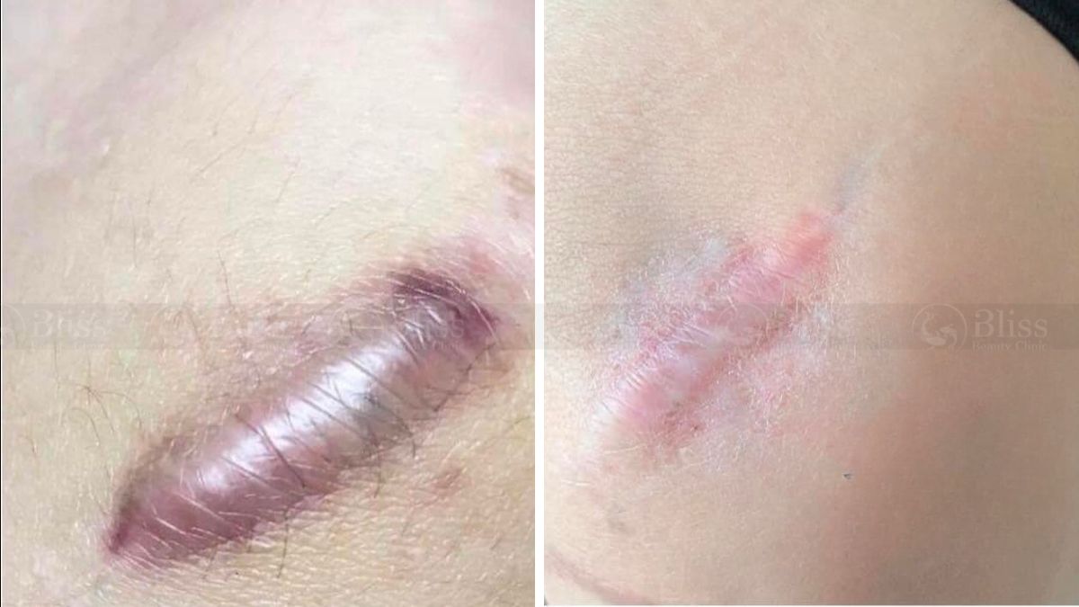 tri-seo-loi-gia-re-tot-nhat-tai-go-vap