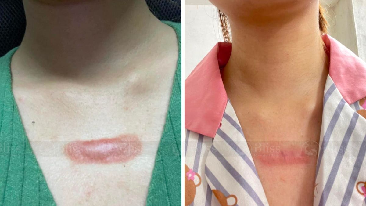 tri-seo-loi-gia-re-tot-nhat-tai-go-vap