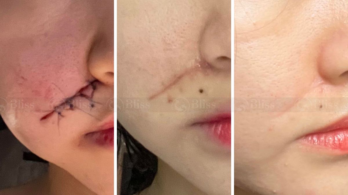 tri-seo-loi-gia-re-tot-nhat-tai-go-vap