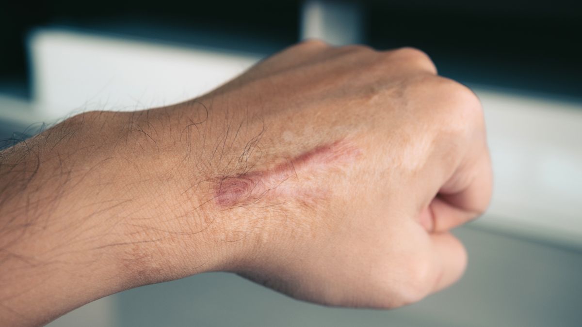 tri-seo-loi-gia-re-tot-nhat-tai-go-vap