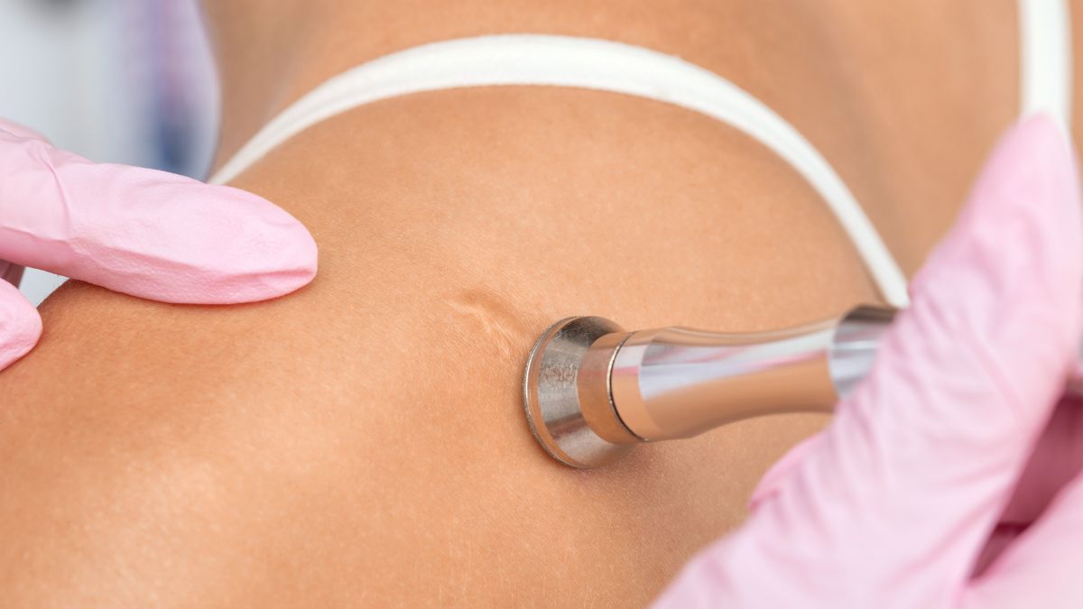 tri-seo-loi-gia-re-tot-nhat-tai-go-vap