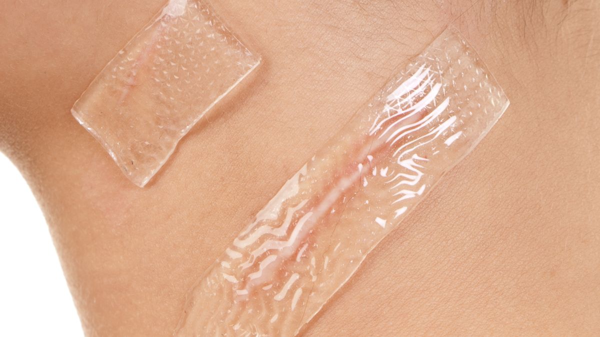 tri-seo-loi-gia-re-tot-nhat-tai-go-vap