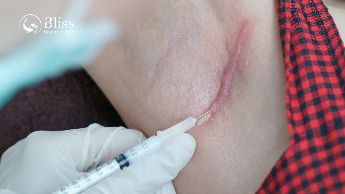 tri-seo-loi-gia-re-tot-nhat-tai-go-vap