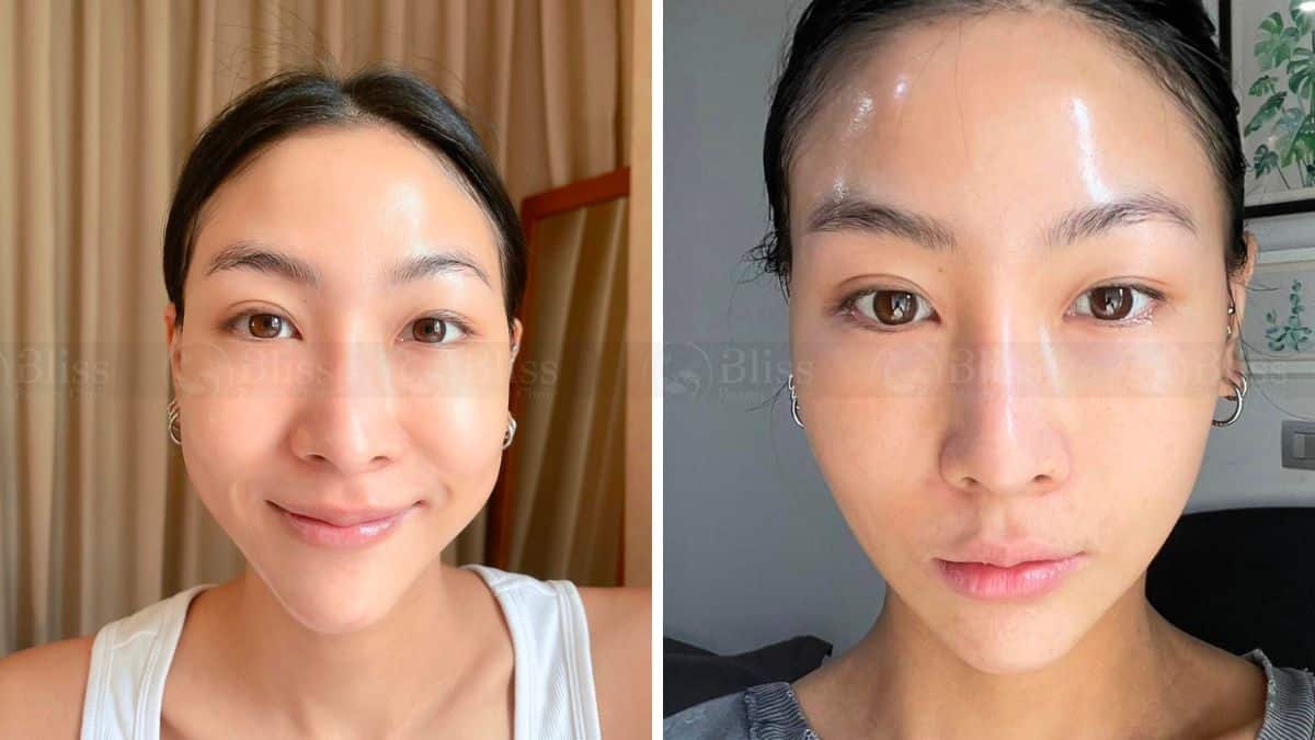 tiem-cang-bong-mesocell-extra