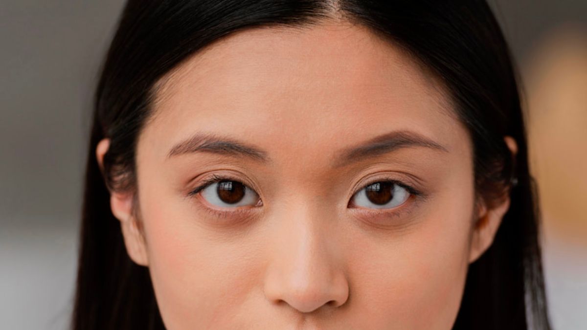 tiem-mesocell-extra-tri-tham-mat