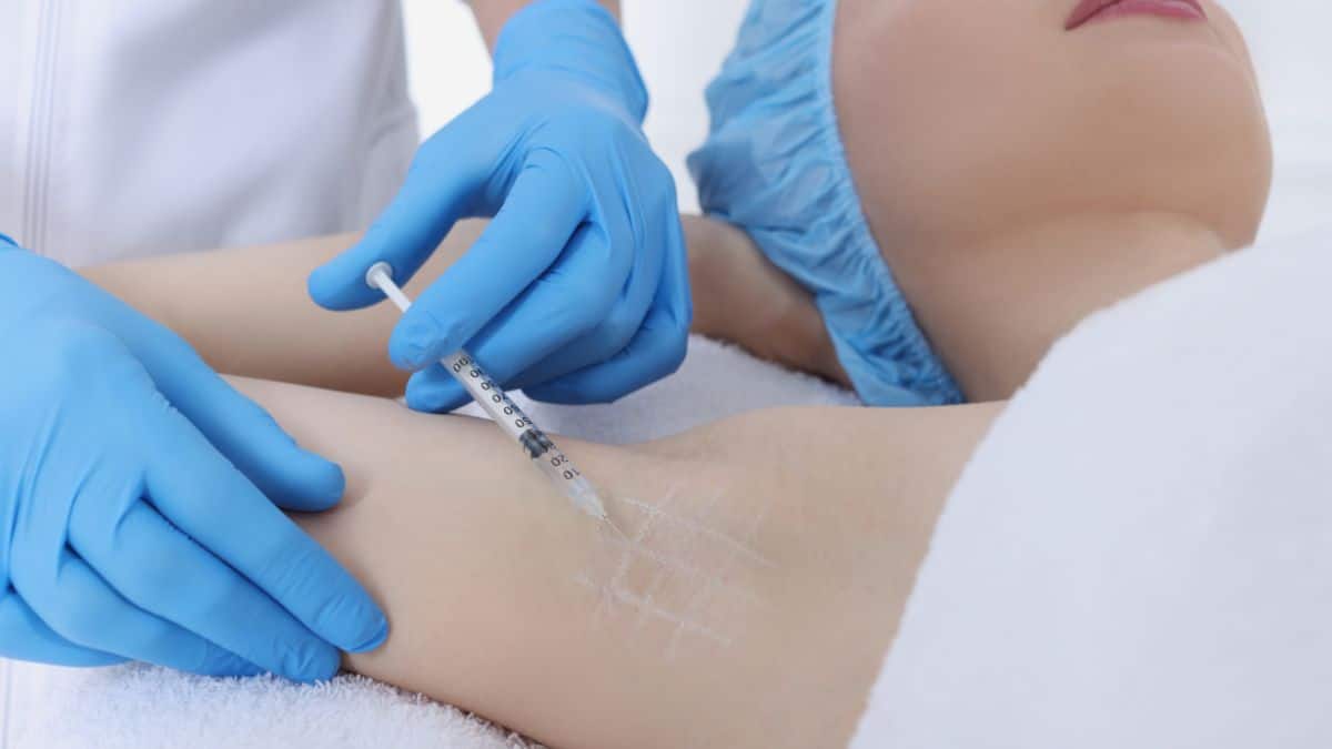 top-cac-phuong-phap-dieu-tri-hoi-nach