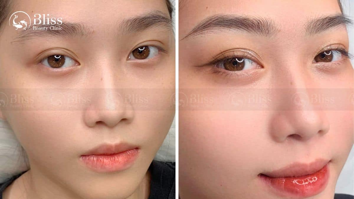 dieu-khac-long-may-hairstroke-la-gi