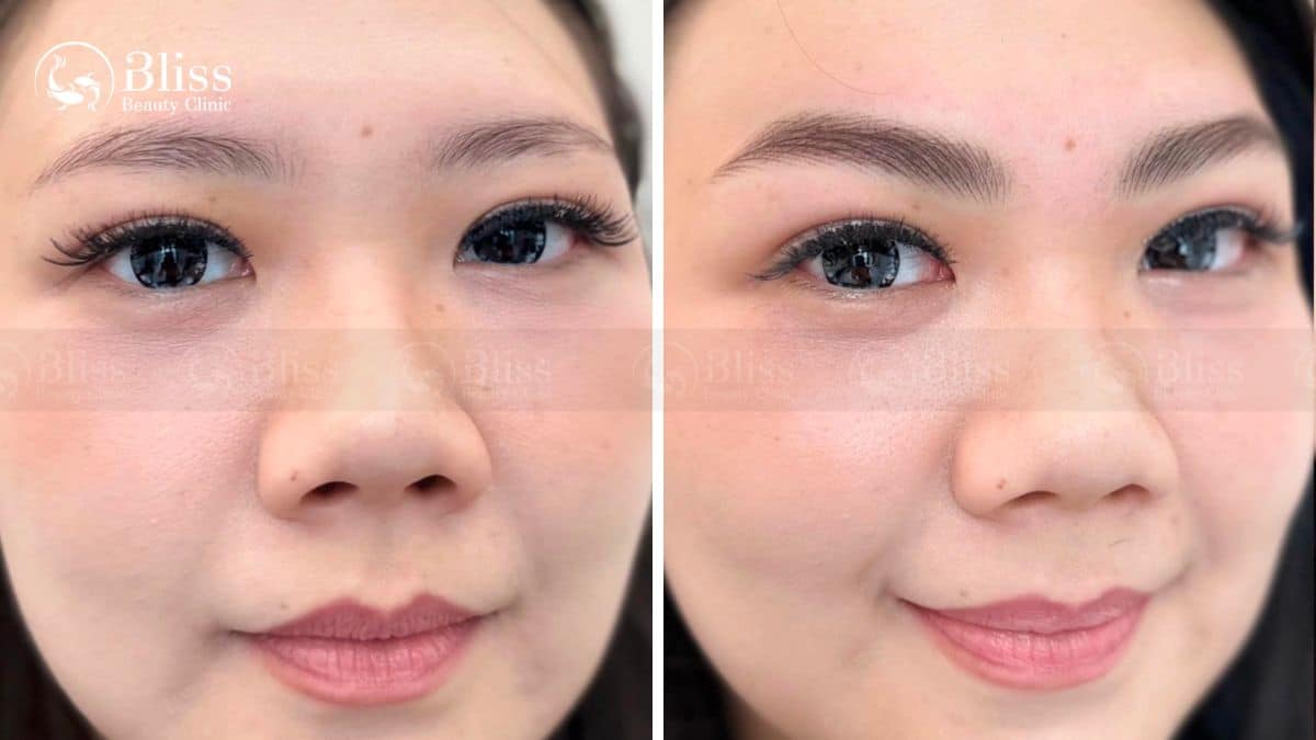 dieu-khac-long-may-hairstroke-la-gi