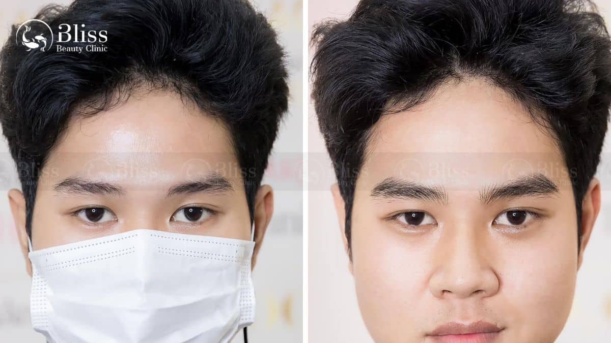 dieu-khac-long-may-hairstroke-la-gi