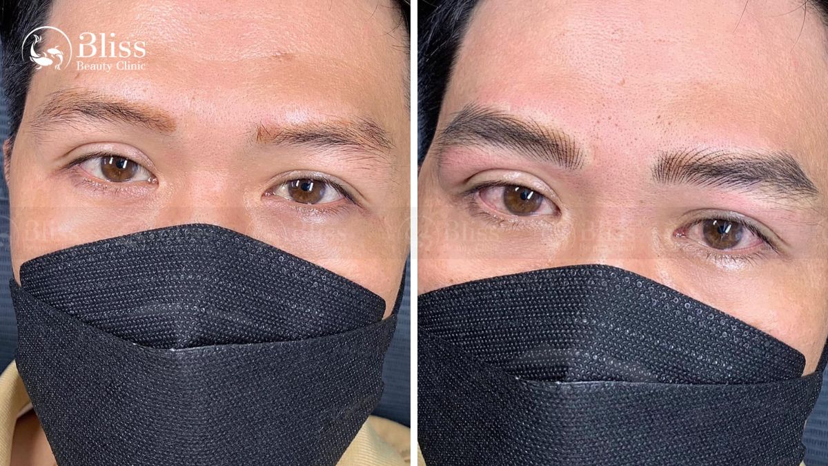 dieu-khac-long-may-hairstroke-la-gi