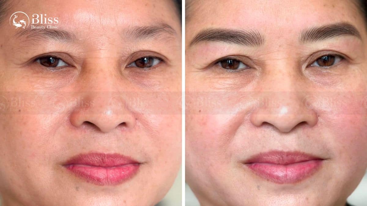 dieu-khac-long-may-hairstroke-la-gi