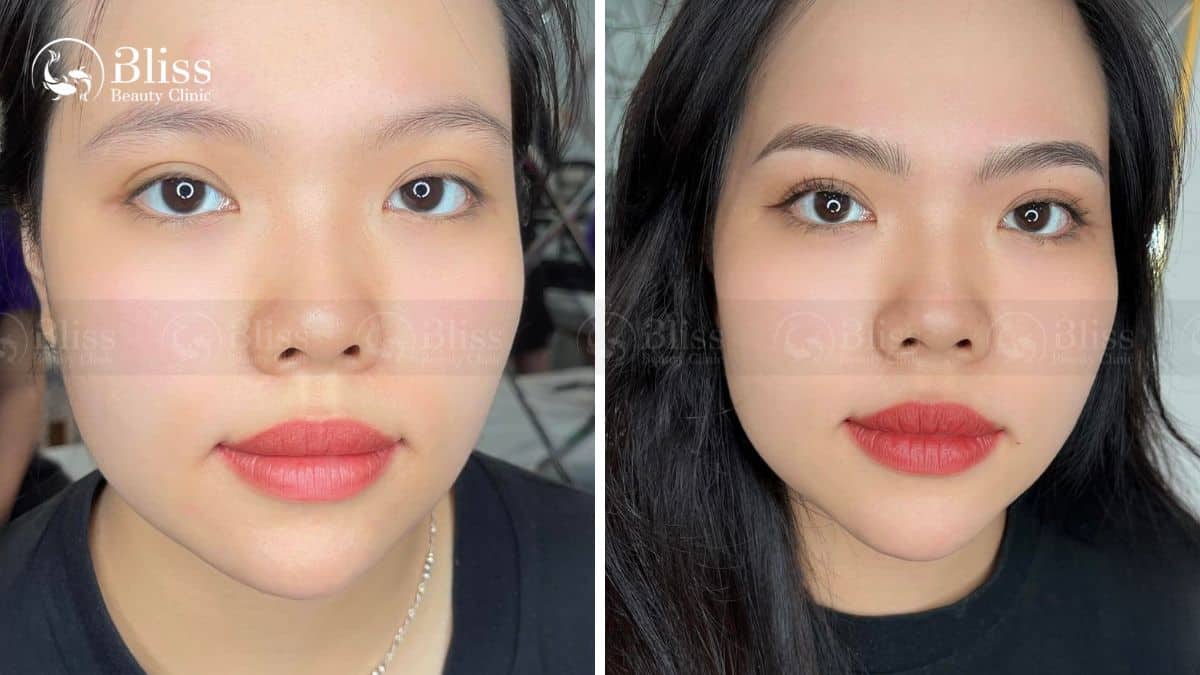 dieu-khac-long-may-hairstroke-la-gi