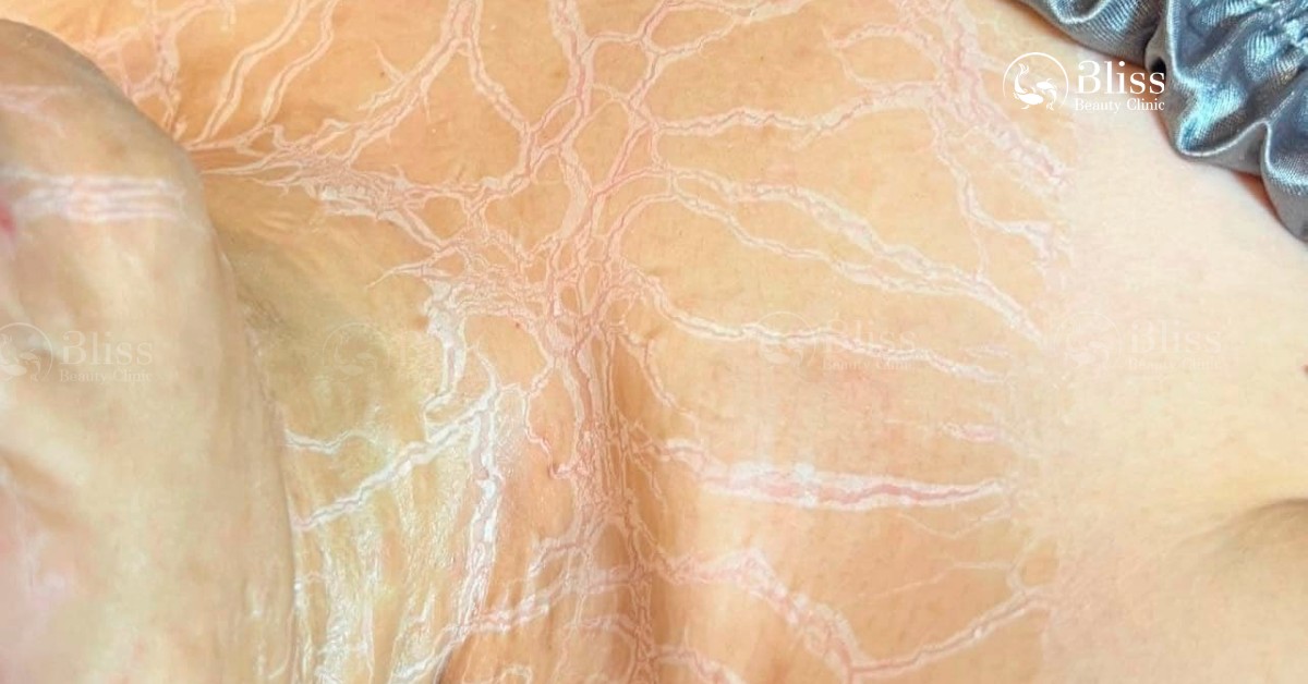 enzyme-therapy-xu-huong-tri-lieu-da-the-ky-moi