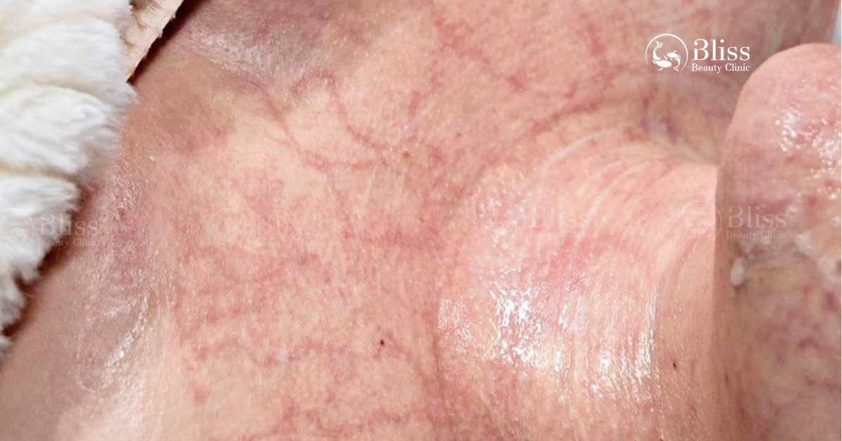 enzyme-therapy-xu-huong-tri-lieu-da-the-ky-moi