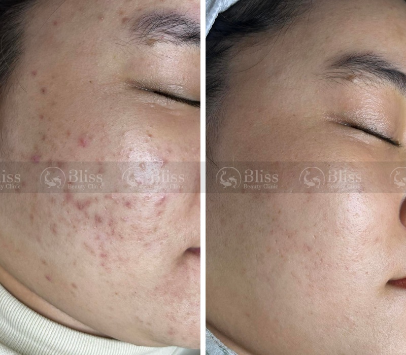 peel-da-dat-set-clay-peel