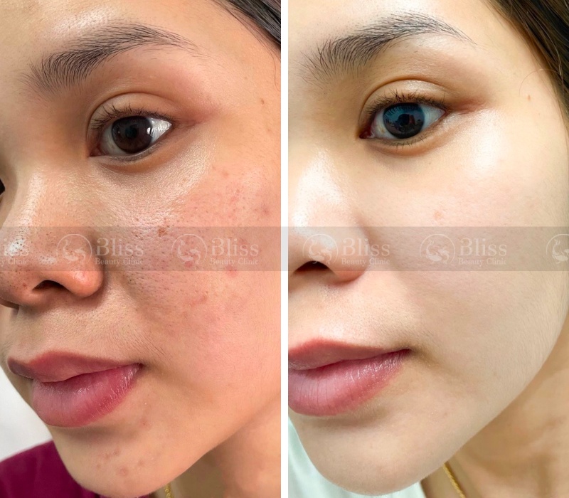 peel-da-dat-set-clay-peel