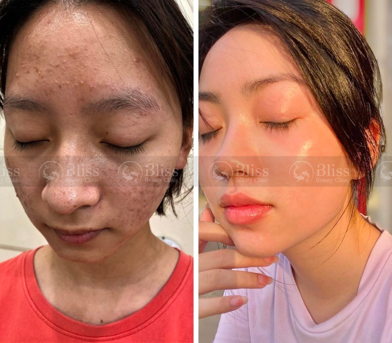 peel-da-dat-set-clay-peel