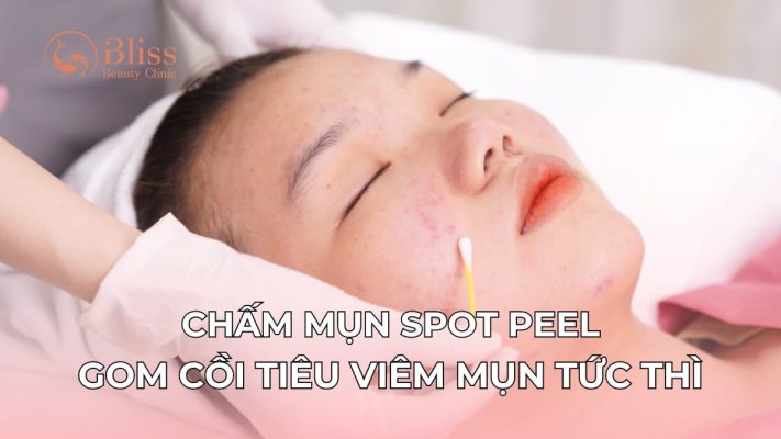 chấm mụn spot peel gom cồi tiêu viêm