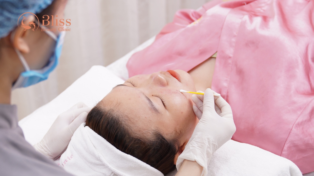 chấm mụn spot peel gom cồi tiêu viêm