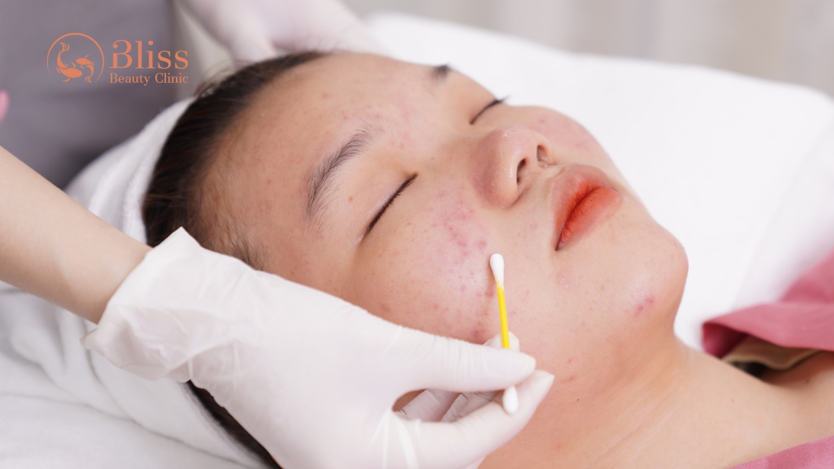 chấm mụn spot peel gom cồi tiêu viêm