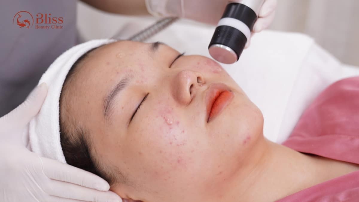 chăm sóc da mụn ẩn chuyên sâu