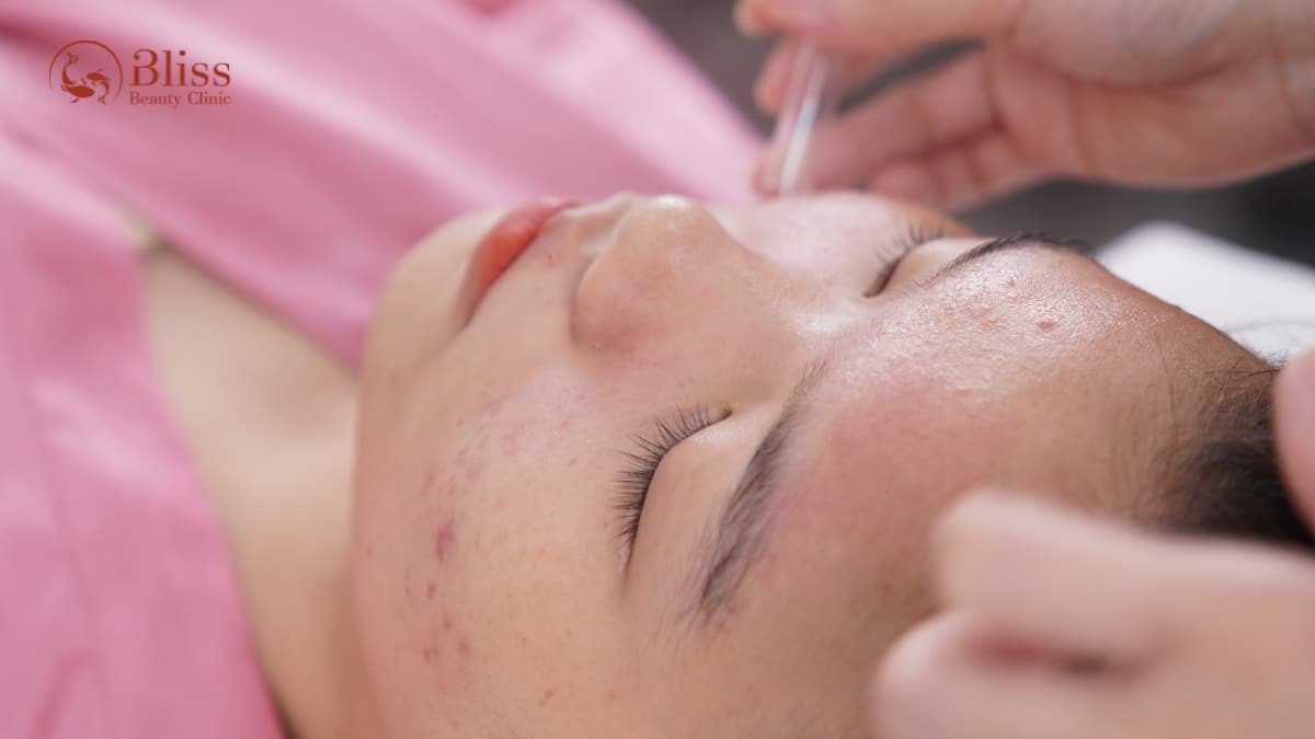 chăm sóc da mụn ẩn chuyên sâu