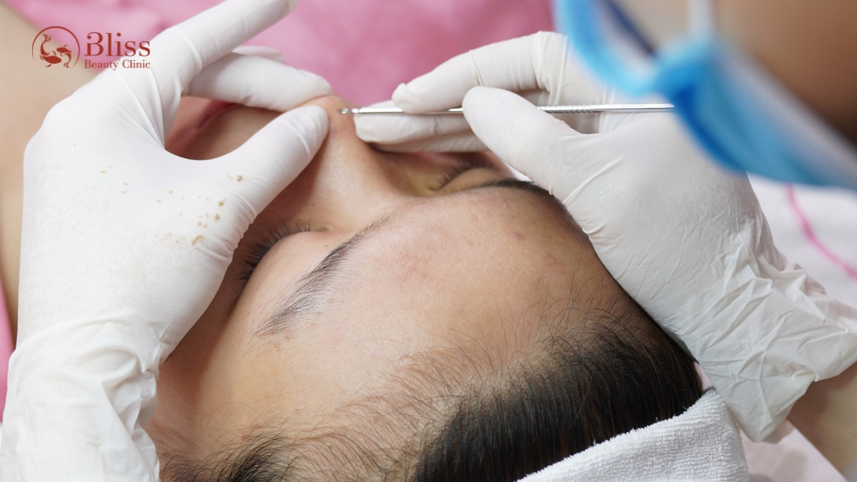 chăm sóc da mụn viêm chuyên sâu