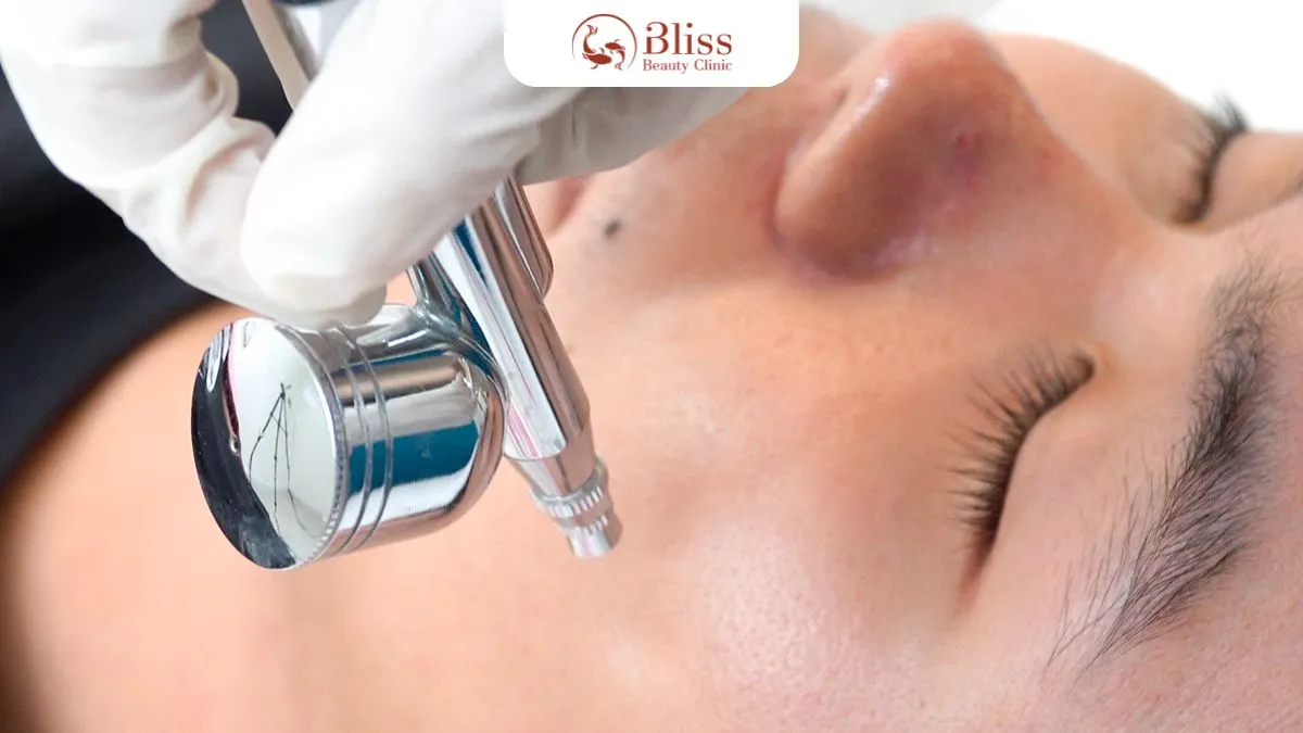 dich-vu-cham-soc-da-mun-cao-cap-acni-diamond