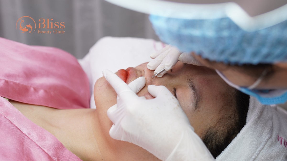 điều trị mụn viêm dứt điểm acni diamond